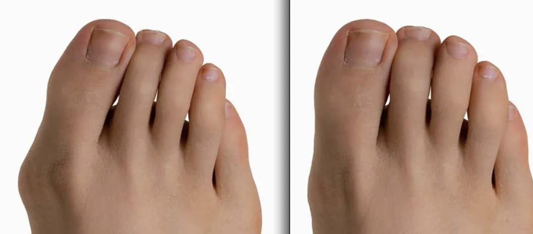 Pentingnya Struktur Alas Kaki untuk Kenyamanan Beraktivitas